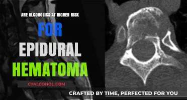 Alcoholism and Epidural Hematoma: Uncovering the Increased Risk Factors