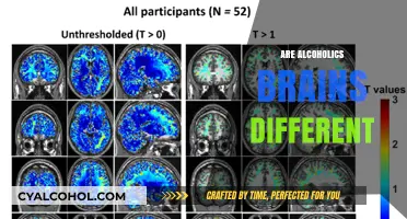How Alcoholism Alters Brain Structure and Function: Key Differences Explained
