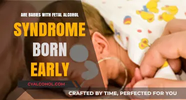 Fetal Alcohol Syndrome: Does Exposure Increase Risk of Preterm Birth?