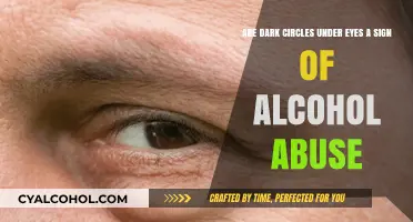 Dark Circles and Alcohol: What's the Link?