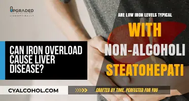 Iron Levels: Non-Alcoholic Steatohepatitis Connection