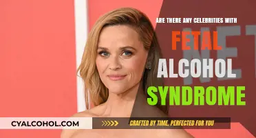 Celebrities and Fetal Alcohol Syndrome: Unveiling Hidden Struggles