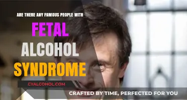 Famous People Living with Fetal Alcohol Syndrome