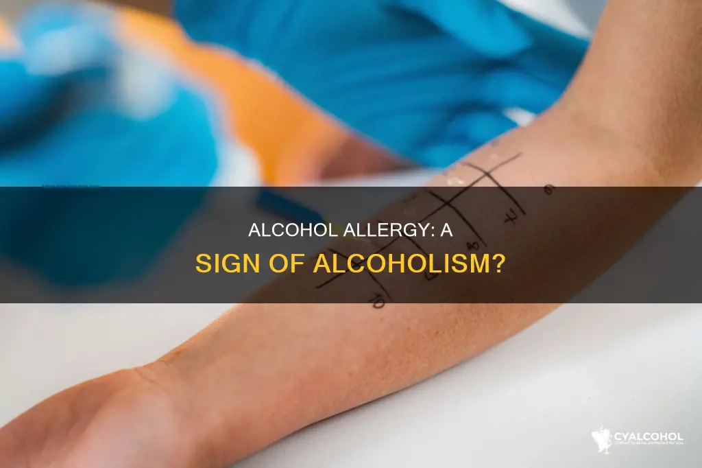 are you an alcoholic if you have an allergic reaction
