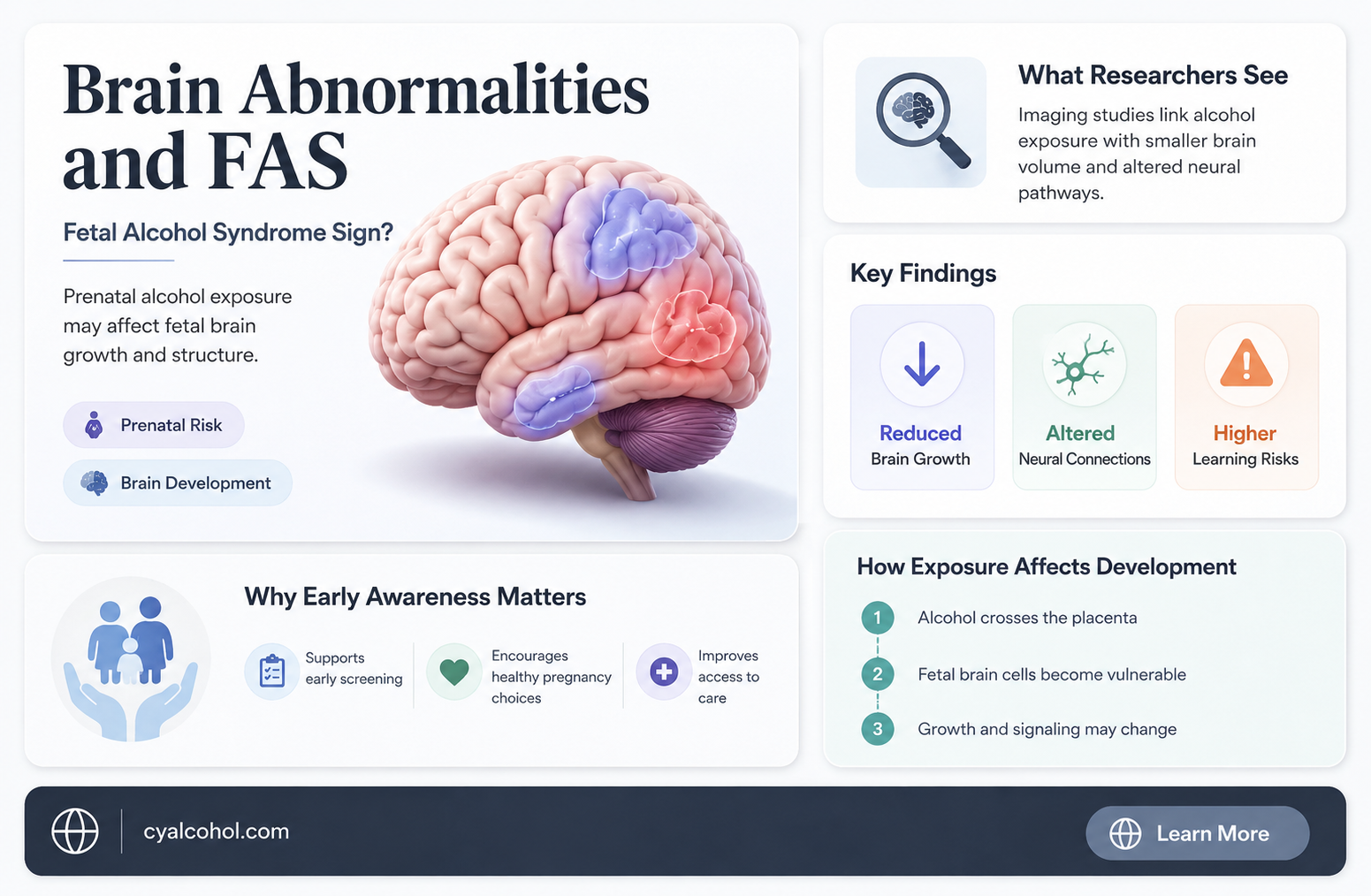 are brain abnormalities a sign of fetal alcohol syndrome