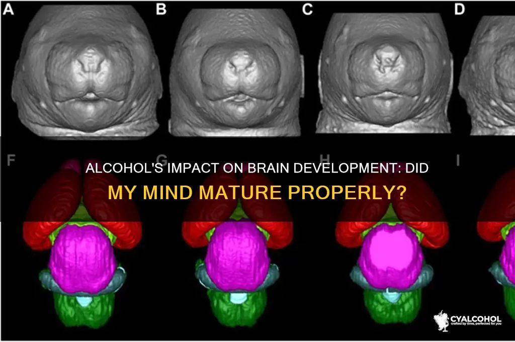 did my brain develop properly due to alcohol
