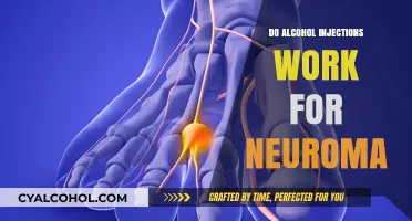 Alcohol Injections for Neuroma: Effectiveness, Risks, and Patient Outcomes