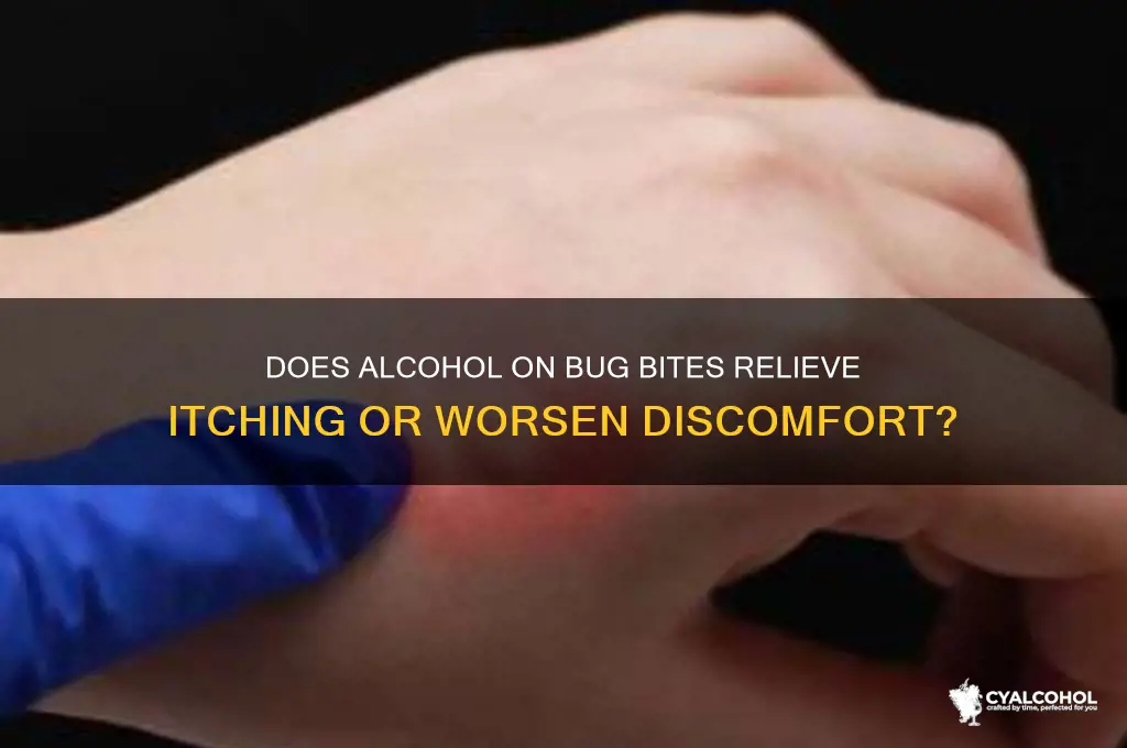 do alcohol on bug bites itch