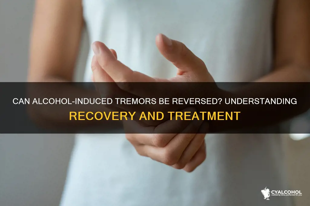 do alcohol tremors go away
