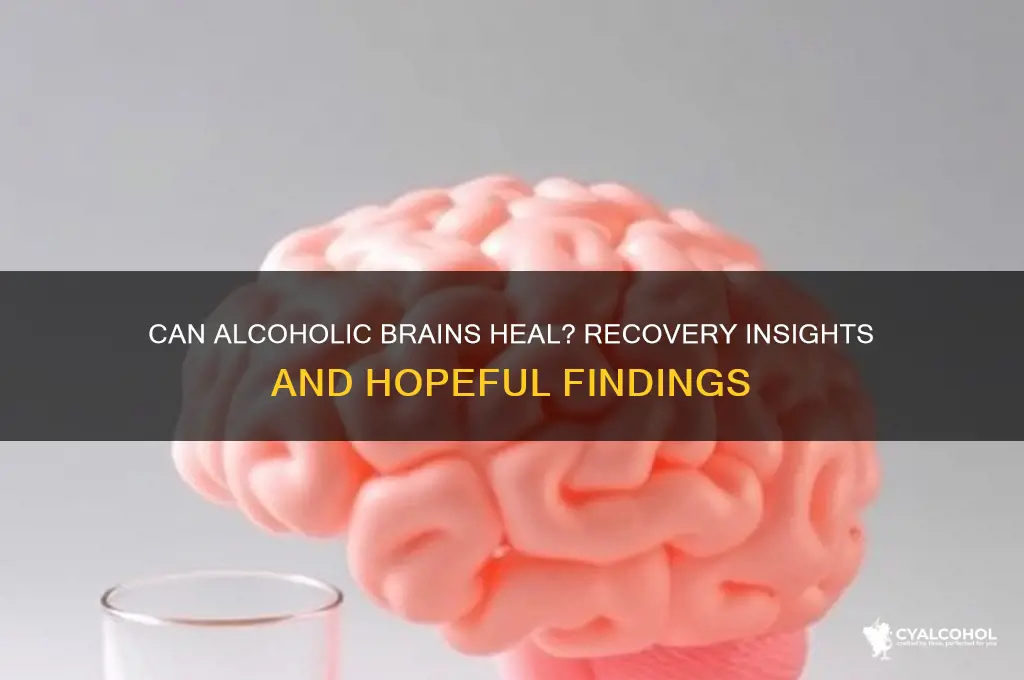 do alcoholic brains recover