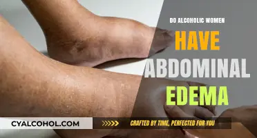 Alcoholic Women and Abdominal Edema: Causes, Risks, and Treatment Options