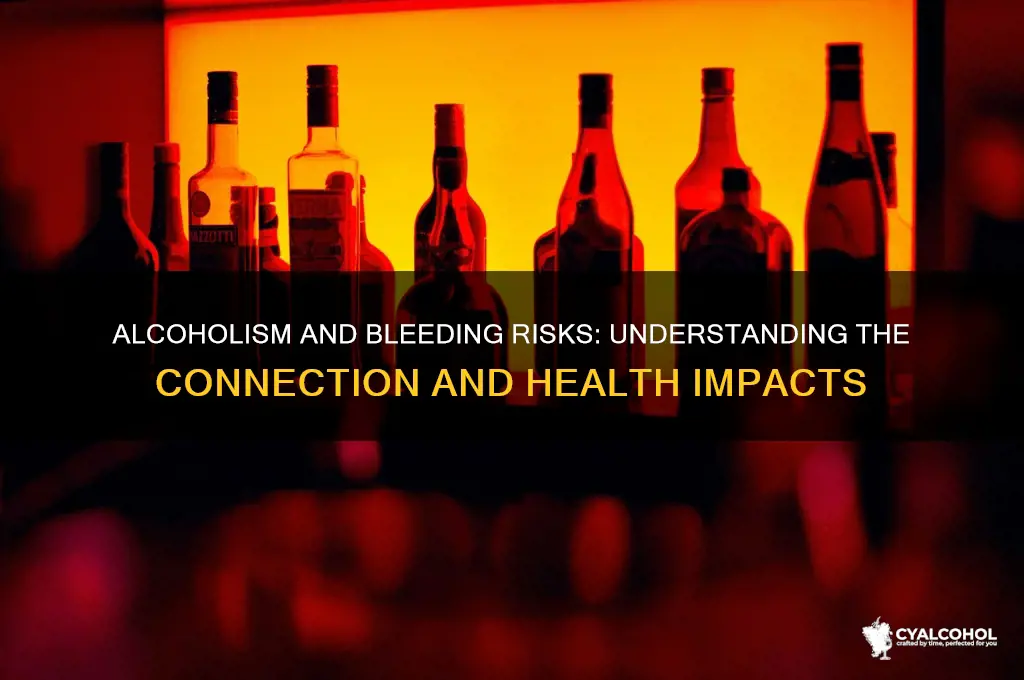do alcoholics bleed easily