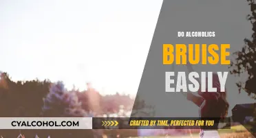 Alcoholism and Bruising: Understanding the Link to Easy Bruising