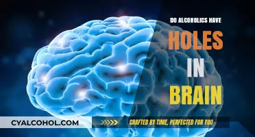 Do Alcoholics Have Holes in Their Brain? Unraveling the Myth