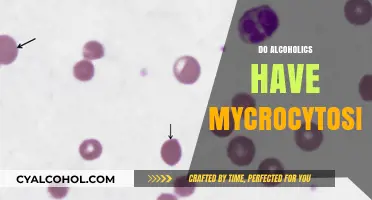 Alcoholism and Microcytosis: Unraveling the Connection in Blood Cell Health
