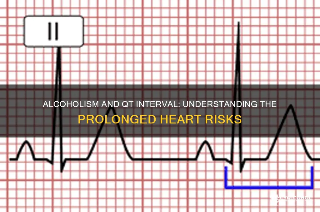 do alcoholics have prolonged qt interval