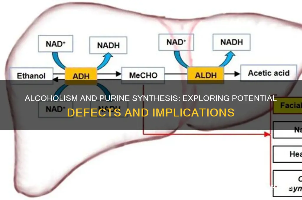 do alcoholics have purine synthesis defects