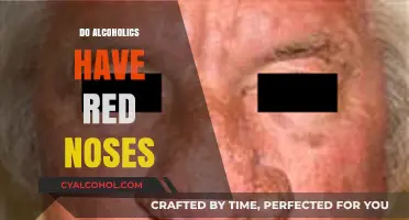 Alcoholic Nose: Unraveling the Myth of Red Noses and Drinking
