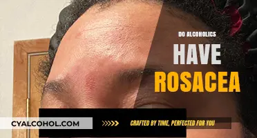Alcohol and Rosacea: Uncovering the Link Between Drinking and Skin Health