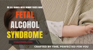 Skinny Faces and FAS: What's the Link?