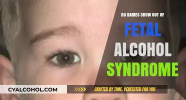 Can Babies Outgrow Fetal Alcohol Syndrome? Understanding Lifelong Impacts
