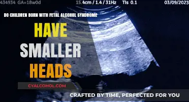 Alcohol's Impact: Smaller Heads in Babies