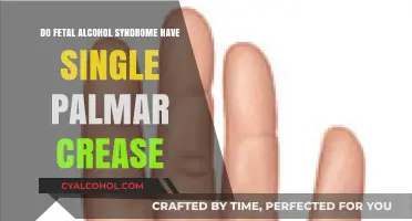 Fetal Alcohol Syndrome and Palmar Crease: Unraveling the Connection