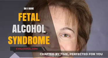 Understanding Fetal Alcohol Syndrome: Symptoms, Diagnosis, and Support Options