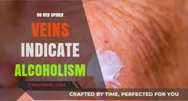 Red Spider Veins: Unraveling the Link to Alcoholism and Health