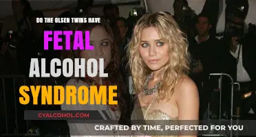 Unraveling the Truth: Olsen Twins and Fetal Alcohol Syndrome Claims