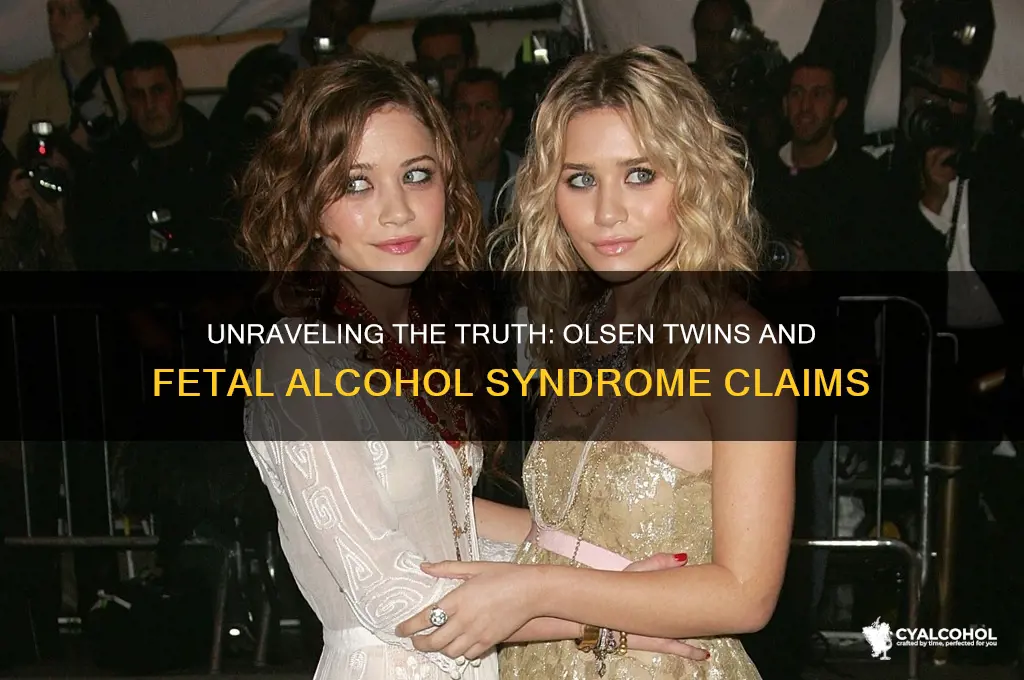 do the olsen twins have fetal alcohol syndrome