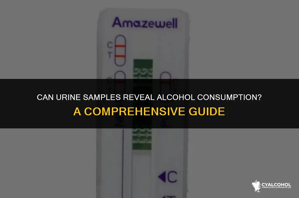 do urine samples show alcohol