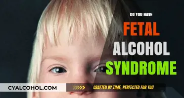 Understanding Fetal Alcohol Syndrome: Symptoms, Diagnosis, and Support Options