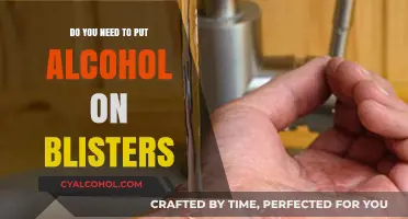 Should You Use Alcohol on Blisters? Facts and Safe Remedies