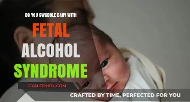 Swaddling Babies with Fetal Alcohol Syndrome: Safety Tips and Considerations