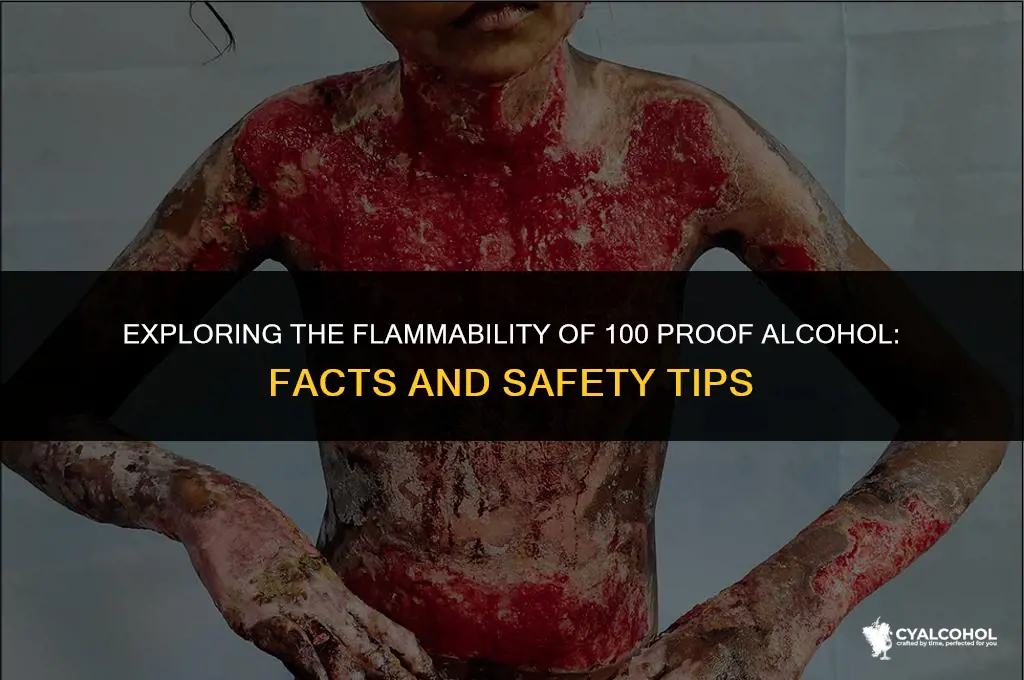 does 100 proof alcohol burn