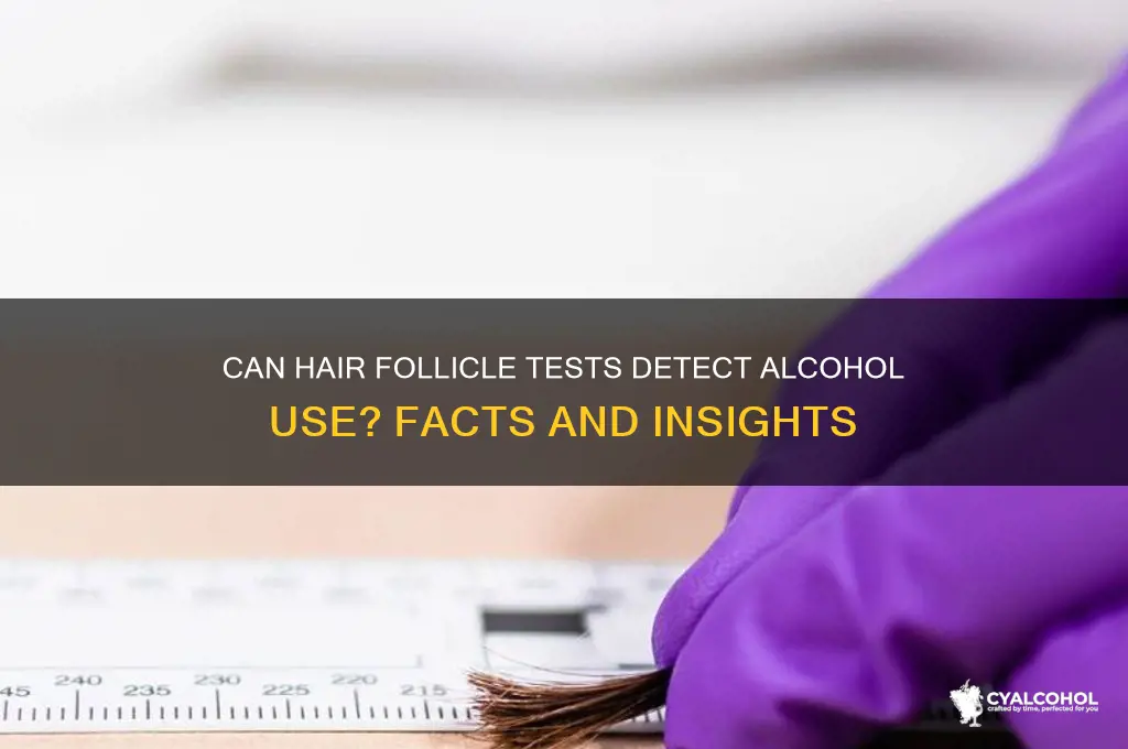 does a hair follicle show alcohol