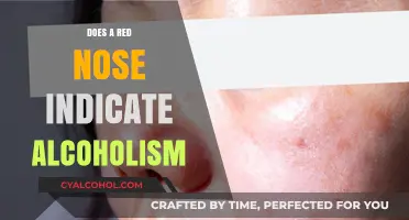 Red Nose and Alcoholism: Unraveling the Myth and Medical Truth
