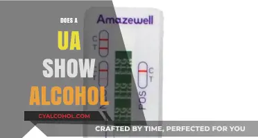 Will a Urine Analysis Reveal Your Alcohol Consumption?