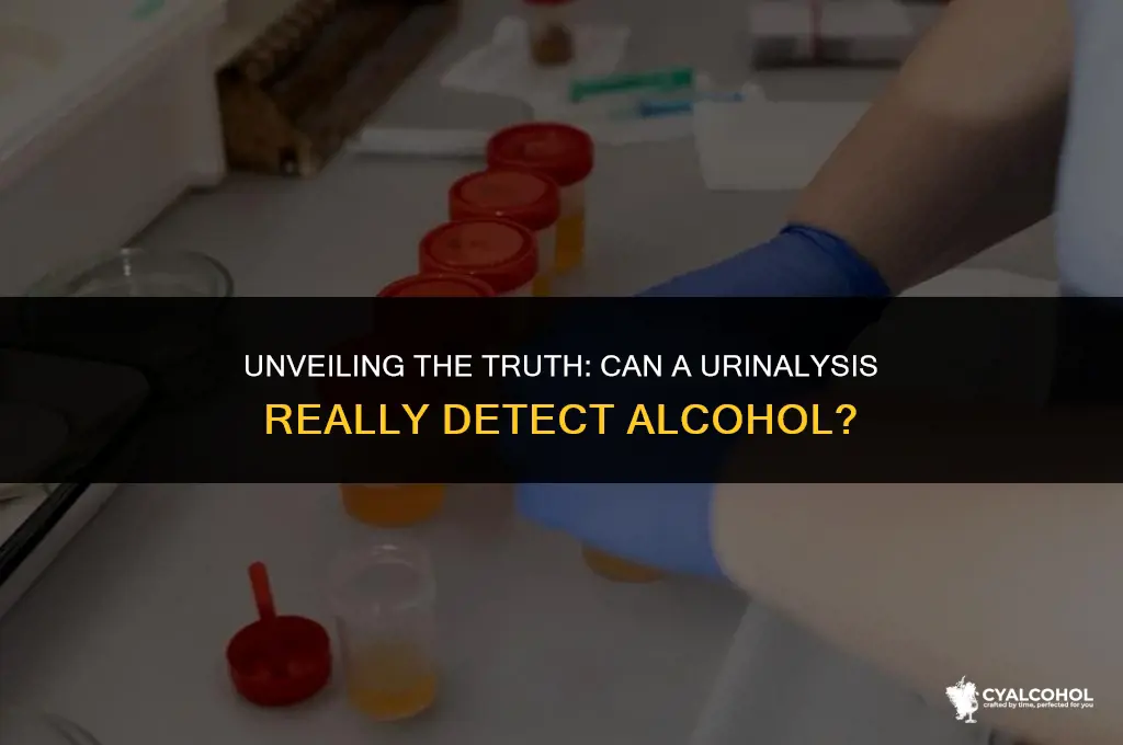does a urinalysis detect alcohol