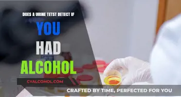Urine Test: Can It Detect Alcohol Consumption?
