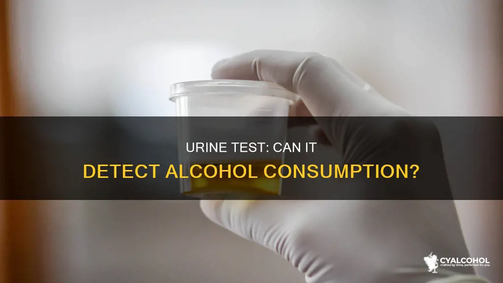 does a urine tetst detect if you had alcohol