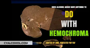 Alcohol Abuse and Hemochromatosis: A Dangerous Combination