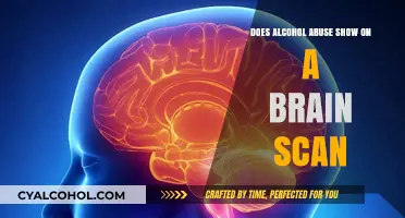 Can Brain Scans Detect Alcohol Abuse? Unveiling the Neurological Impact