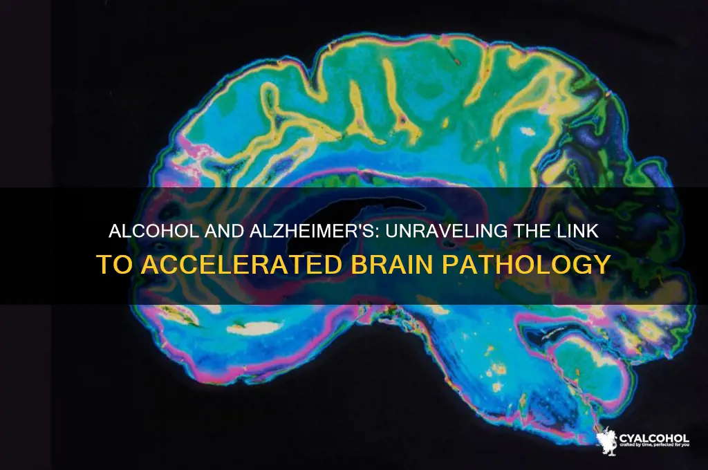 does alcohol accelerate alzheimer disease pathology