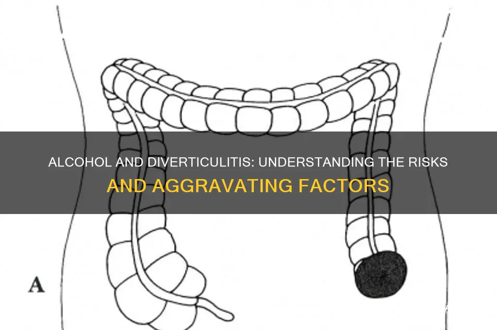 does alcohol aggravate diverticulitis