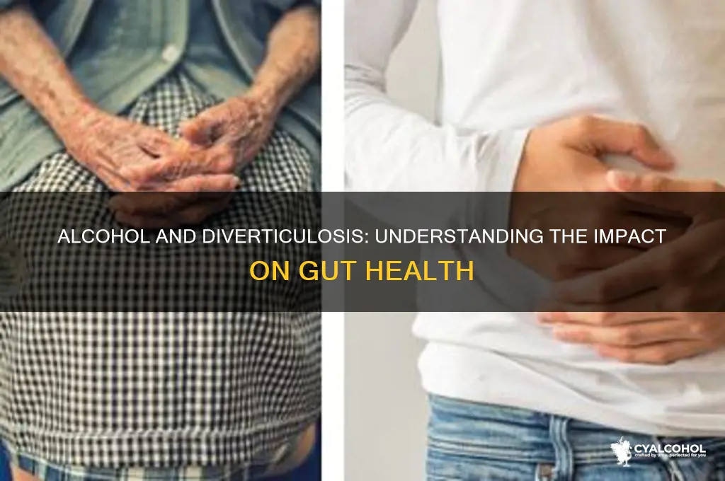 does alcohol aggravate diverticulosis