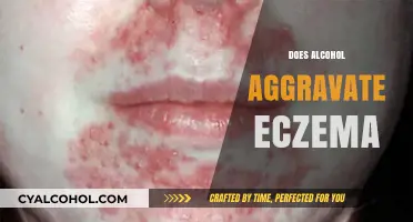 Alcohol and Eczema: Understanding the Link and Potential Aggravation