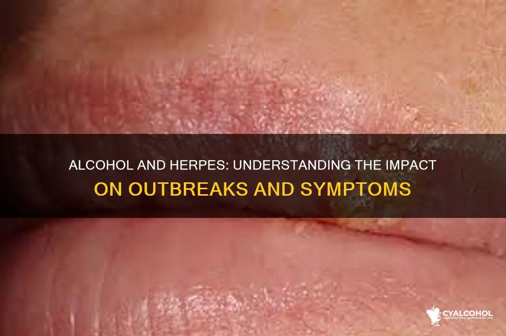 does alcohol aggravate herpes