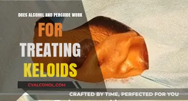 Alcohol and Peroxide for Keloids: Effective Treatment or Myth?